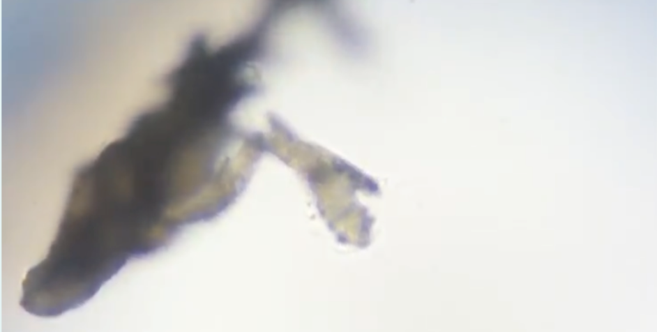 it's an overgrowth of mites video thumbnail